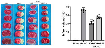1,25-D3 attenuates cerebral ischemia injury by regulating mitochondrial metabolism via the AMPK/AKT/GSK3β pathway